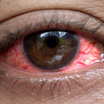 Användning av statiner ökar risken för ögonsjukdomar